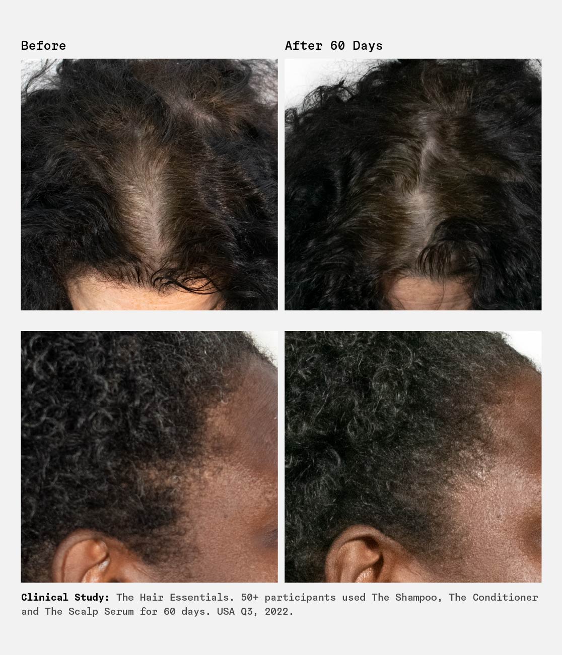 The Scalp Serum Trio | 90-Day Supply | 1% Hyaluronic Acid - Image 5